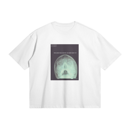 X-Ray Oversized Tee