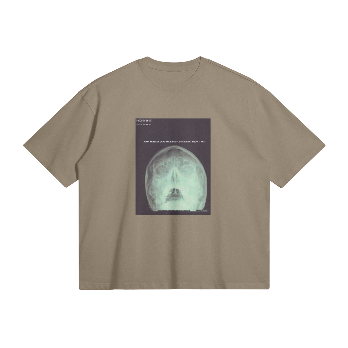 X-Ray Oversized Tee