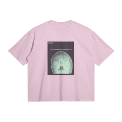 X-Ray Oversized Tee